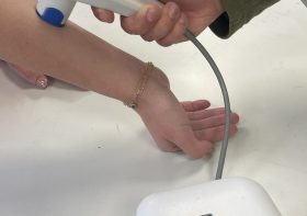 Revolutionary eczema treatment ‘could end years of suffering’ for patients